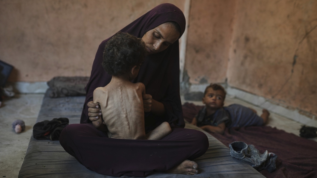 Una madre palestina sostiene a su hijo desnutrido en el campamento de refugiados de Shati, en Gaza, 23 de julio de 2025. Jehad Alshrafi / AP