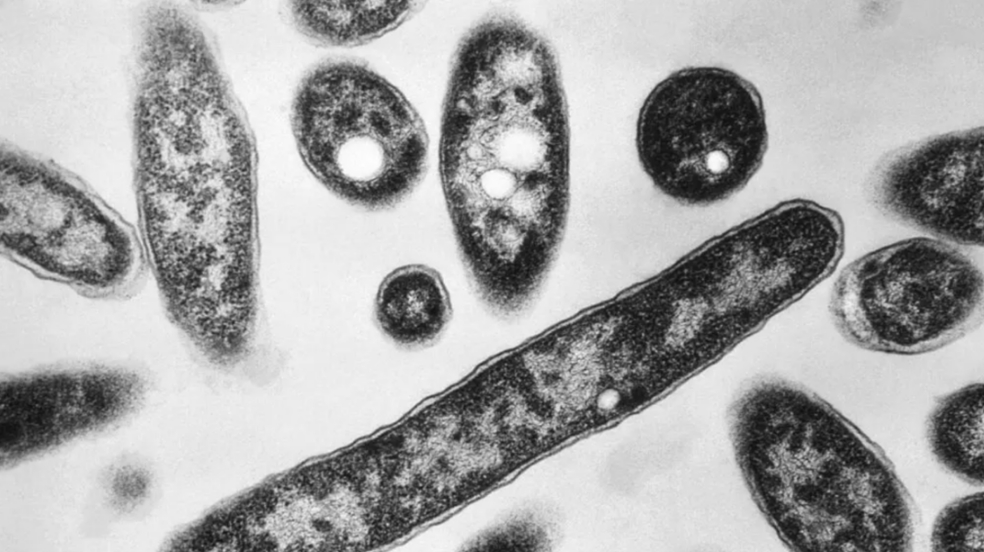 Francis Chandler / Centers for Disease Control and Prevention / AP